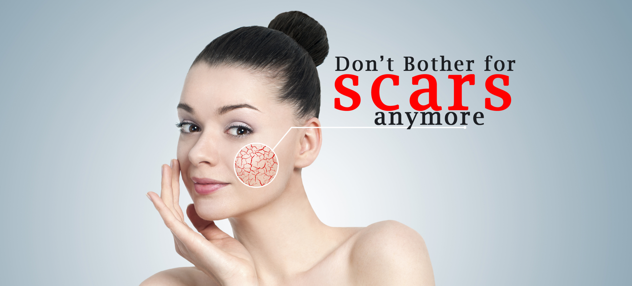 Most effective ways to get rid of pimple scars
